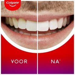 Outlet Colgate Max White Overnight Whitening Serum