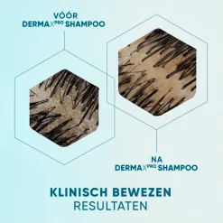 Outlet Head & Shoulders DermaXPro by Revitaliseert Antiroosshampoo