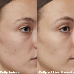 Online ELF e.l.f. Skin PLZ Clarify Facial Oil