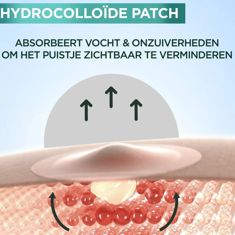 Outlet Garnier Skin Naturals Garnier PureActive Pimple Patches