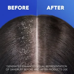 Discount Head & Shoulders Classic Clean 2-in-1 Shampoo met Pomp