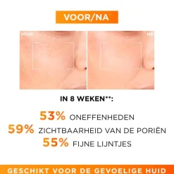 Clearance L'Oreal Paris L'Oréal Paris Revitalift Clinical Pure Vitamine C 12% Serum