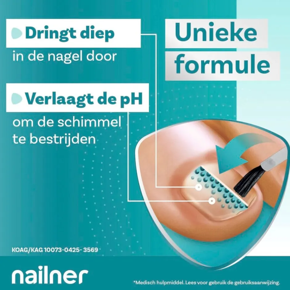 Best Nailner Multi-Action Kalknagelpen