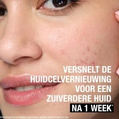 Hot Neutrogena Anti-Puistjes+ 7% AHA + Panthenol Vloeibare Exfoliant