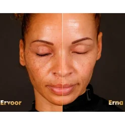 Sale Nivea Skincare NIVEA Cellular Luminous630 Anti-Spot SPF50 Dagcrème