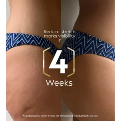 Best Nivea Luminous630 Anti-Striae/Anti-Striemen Body Oil-Serum