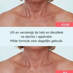 Online Remescar Hals & Décolleté Crème